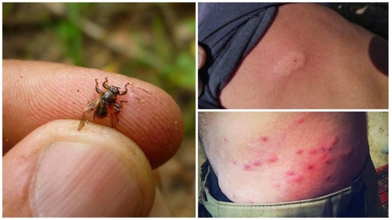 Pericolo per l'uomo per un morso di succhiasangue
