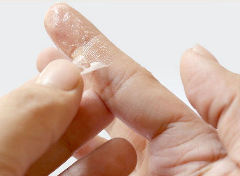 Pelez la colle Moment des mains