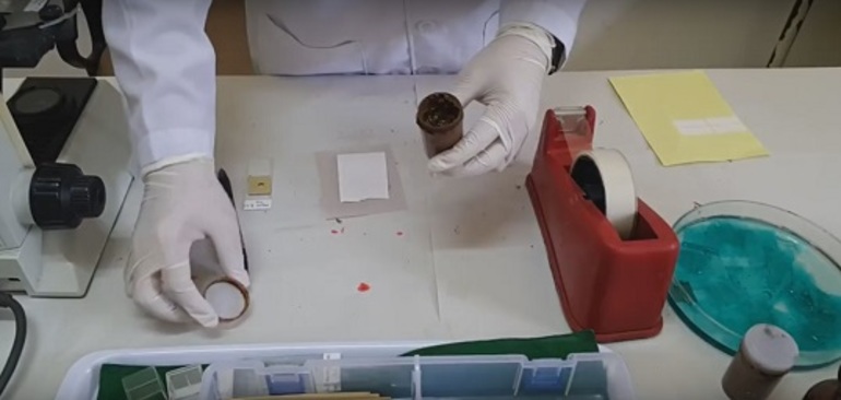 Examen des matières fécales selon la méthode de Fulleborn